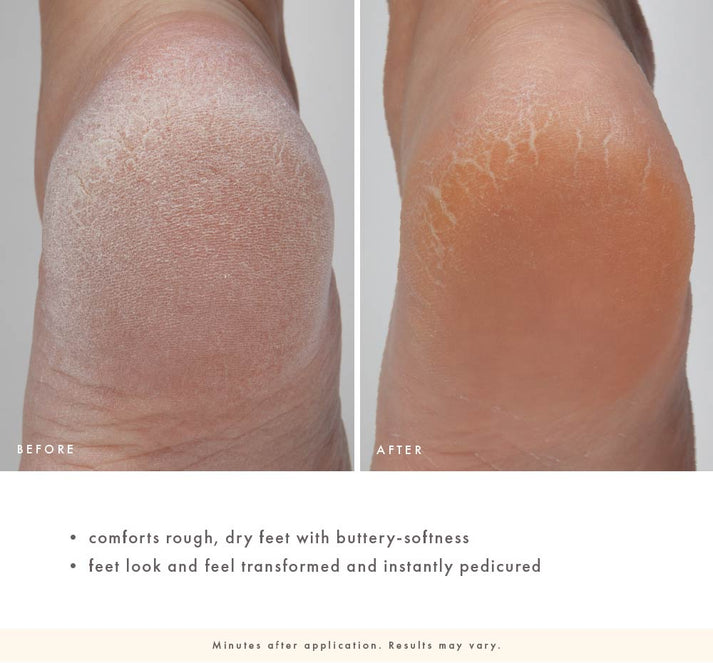 Enrich Mint® Foot Rescue Mask